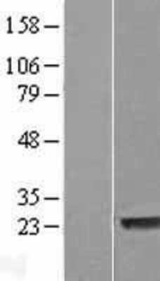 Western Blot: LYSMD1 Overexpression Lysate [NBL1-12768]