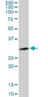 Western Blot: LYSMD2 Antibody [H00256586-B01P]