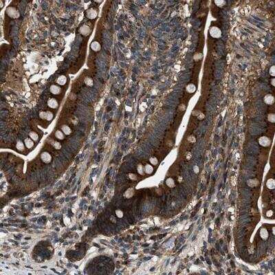 Immunohistochemistry-Paraffin: LYSMD3 Antibody [NBP1-82251]