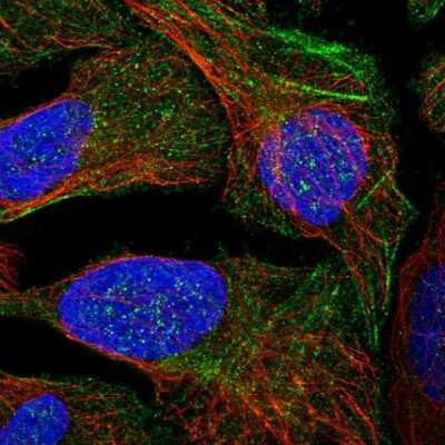 Immunocytochemistry/ Immunofluorescence: LYSMD4 Antibody [NBP1-83511]