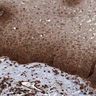 Immunohistochemistry-Paraffin: LYSMD4 Antibody [NBP1-83511]