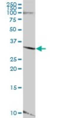 Western Blot: LYSMD4 Antibody [H00145748-B01P]