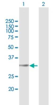 Western Blot: LYSMD4 Antibody [H00145748-B01P]