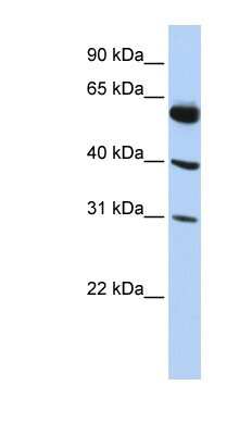 Western Blot: LYSMD4 Antibody [NBP1-62190]