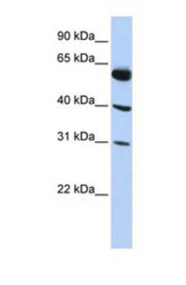 Western Blot: LYSMD4 Antibody [NBP1-69234]