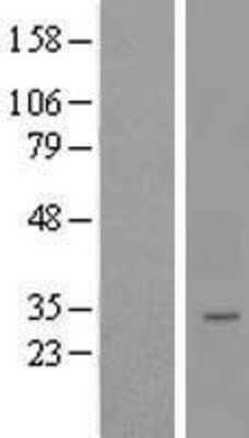 Western Blot: LYSMD4 Overexpression Lysate [NBL1-12769]