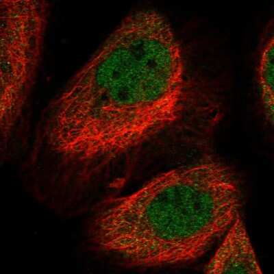 Immunocytochemistry/ Immunofluorescence: LYST Antibody [NBP2-58768]