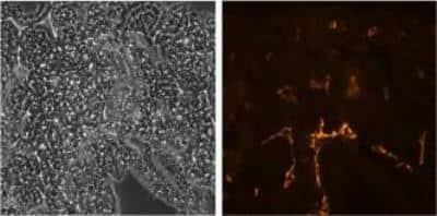 Immunohistochemistry: LYVE-1 Antibody (ALY7) - BSA Free [NBP1-43411]