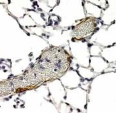 Immunohistochemistry: LYVE-1 Antibody - BSA Free [NB100-725]