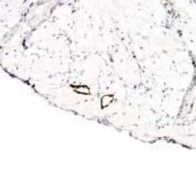 Immunohistochemistry: LYVE-1 Antibody - BSA Free [NB100-725]