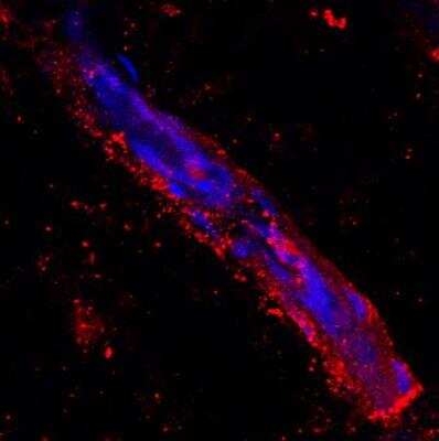 Immunohistochemistry: LYVE-1 Antibody [NB600-1005]