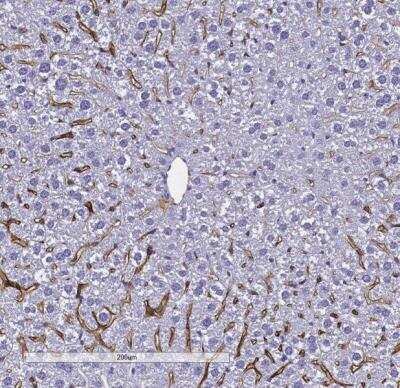 Immunohistochemistry-Paraffin: LYVE-1 Antibody [NB600-1008]