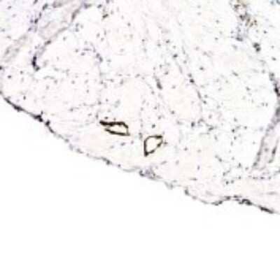 Immunohistochemistry: LYVE-1 Antibody Pack [NB100-939]