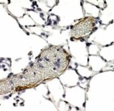 Immunohistochemistry: LYVE-1 Antibody Pack [NB100-939]
