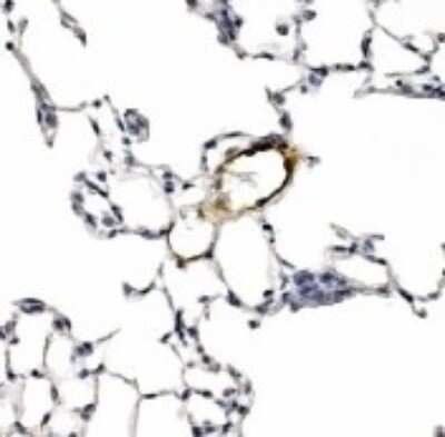 Immunohistochemistry: LYVE-1 Antibody Pack [NB100-939]