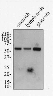 Western Blot: LYVE-1 Antibody Pack [NB100-939]