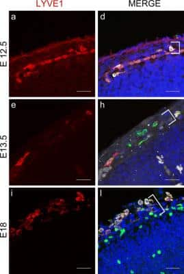 Immunohistochemistry: LYVE-1 Antibody (RM0033-4D17) - Azide and BSA Free [NB110-61026]