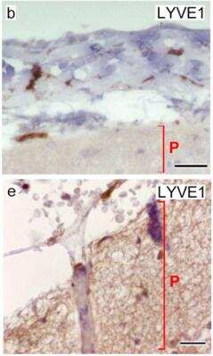 Immunohistochemistry: LYVE-1 Antibody (RM0033-4D17) - Azide and BSA Free [NB110-61026]