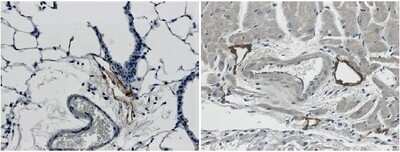 Immunohistochemistry-Paraffin: LYVE-1 Antibody (RM0033-4D17) - Azide and BSA Free [NB110-61026]