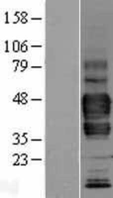 Western Blot: LYVE-1 Overexpression Lysate [NBL1-12770]