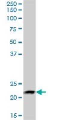 Western Blot: LYZL1 Antibody [H00084569-B01P]