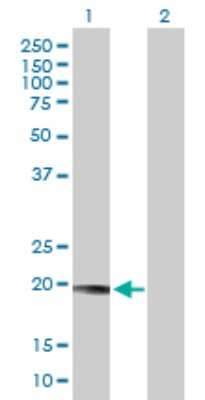 Western Blot: LYZL1 Antibody [H00084569-B01P]