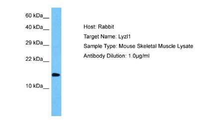 Western Blot: LYZL1 Antibody [NBP2-86704]