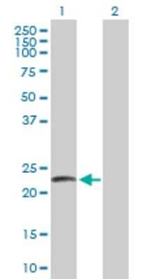 Western Blot: LYZL2 Antibody [H00119180-B01P]