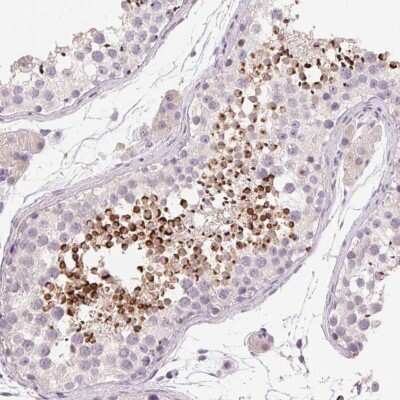 Immunohistochemistry: LYZL6 Antibody [NBP2-49072]