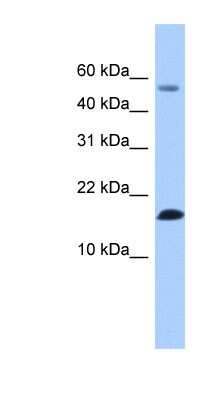 Western Blot: LYZL6 Antibody [NBP1-58032]