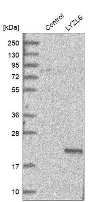 Western Blot: LYZL6 Antibody [NBP1-82810]