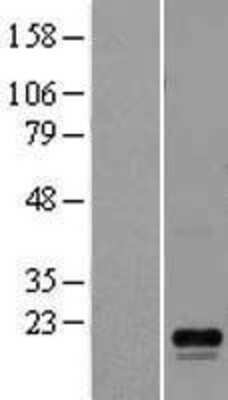 Western Blot: LYZL6 Overexpression Lysate [NBL1-12774]