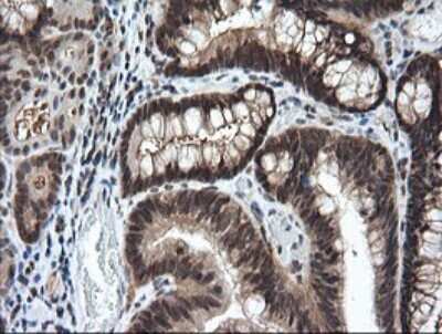 Immunohistochemistry: LZIC Antibody (OTI5E3) [NBP2-45796]
