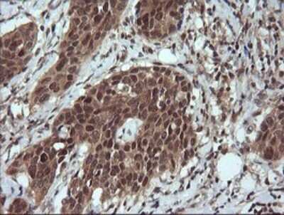 Immunohistochemistry: LZIC Antibody (OTI5E3) [NBP2-45796]