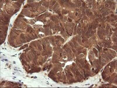 Immunohistochemistry: LZIC Antibody (OTI5E3) [NBP2-45796]