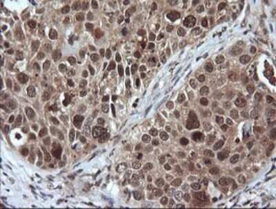 Immunohistochemistry: LZIC Antibody (OTI5E3) [NBP2-45796]