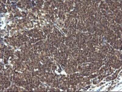 Immunohistochemistry: LZIC Antibody (OTI5E3) [NBP2-45796]