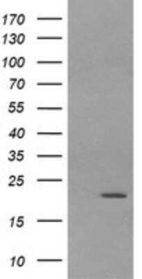 Western Blot: LZIC Antibody (OTI5E3) [NBP2-45796]