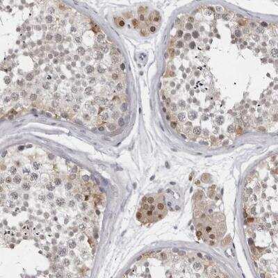 Immunohistochemistry: LZIC Antibody [NBP1-81197]