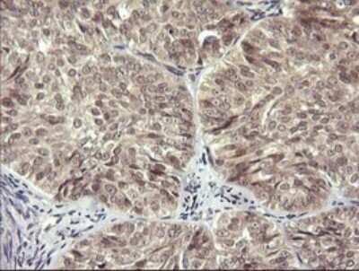 Immunohistochemistry: LZIC Antibody (OTI2D4) [NBP2-45704]