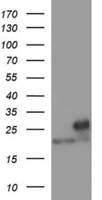 Western Blot: LZIC Antibody (OTI3A7)Azide and BSA Free [NBP2-72559]