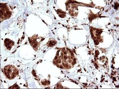 Immunohistochemistry: LZIC Antibody (OTI3A7) [NBP2-45703]