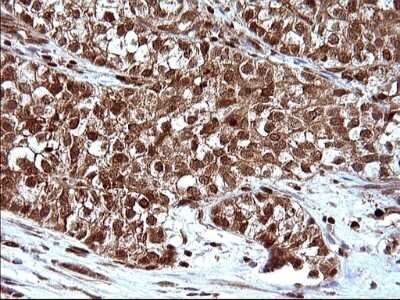 Immunohistochemistry: LZIC Antibody (OTI3A7) [NBP2-45703]