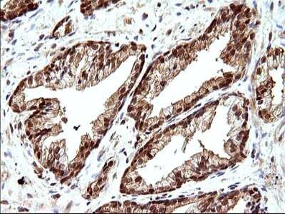 Immunohistochemistry: LZIC Antibody (OTI3A7) [NBP2-45703]