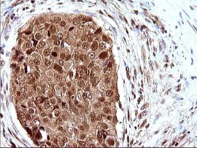 Immunohistochemistry: LZIC Antibody (OTI3A7) [NBP2-45703]