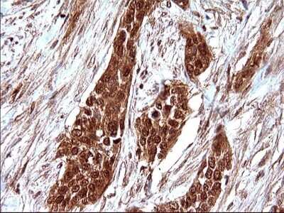 Immunohistochemistry: LZIC Antibody (OTI3A7) [NBP2-45703]