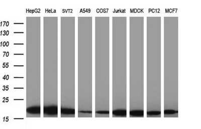 Western Blot: LZIC Antibody (OTI3A7) [NBP2-45703]
