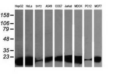 Western Blot: LZIC Antibody (OTI5E3)Azide and BSA Free [NBP2-72561]