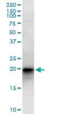 Western Blot: LZIC Antibody [H00084328-B01P]