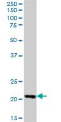 Western Blot: LZIC Antibody [H00084328-B01P]